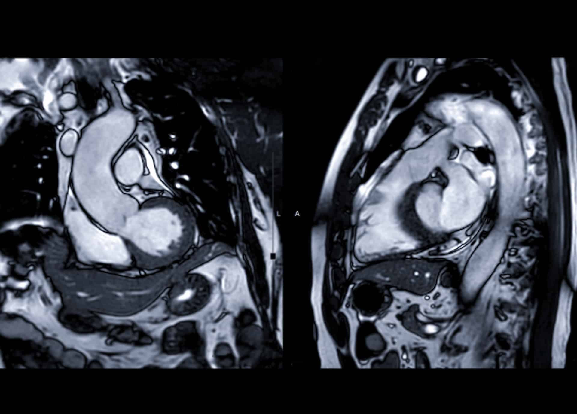 Cardio-thoracique | Centre de radiologie IRM et scanner | Imagerie médicale HPA | Antony