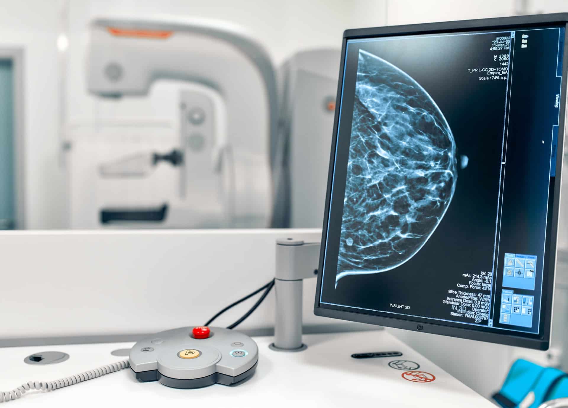 Imagerie de la femme | Centre de radiologie IRM et scanner | Imagerie médicale HPA | Antony