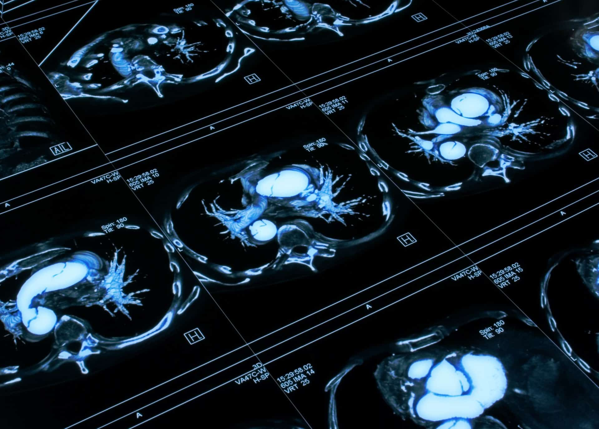 IRM cardiaque | Centre de radiologie IRM et scanner | Imagerie médicale HPA | Antony