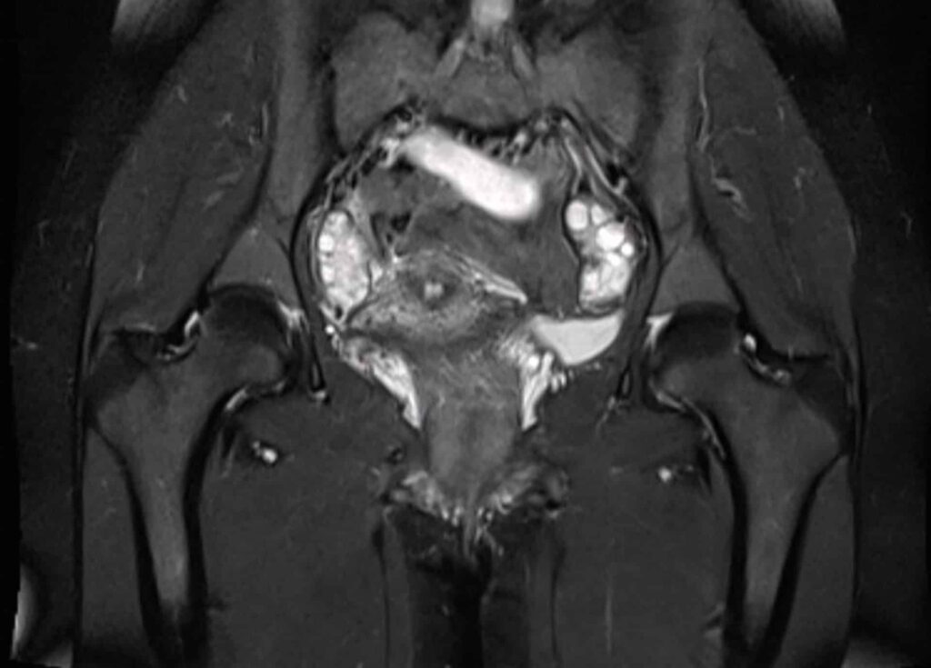IRM pelvienne Centre de radiologie Olympe Imagerie Antony