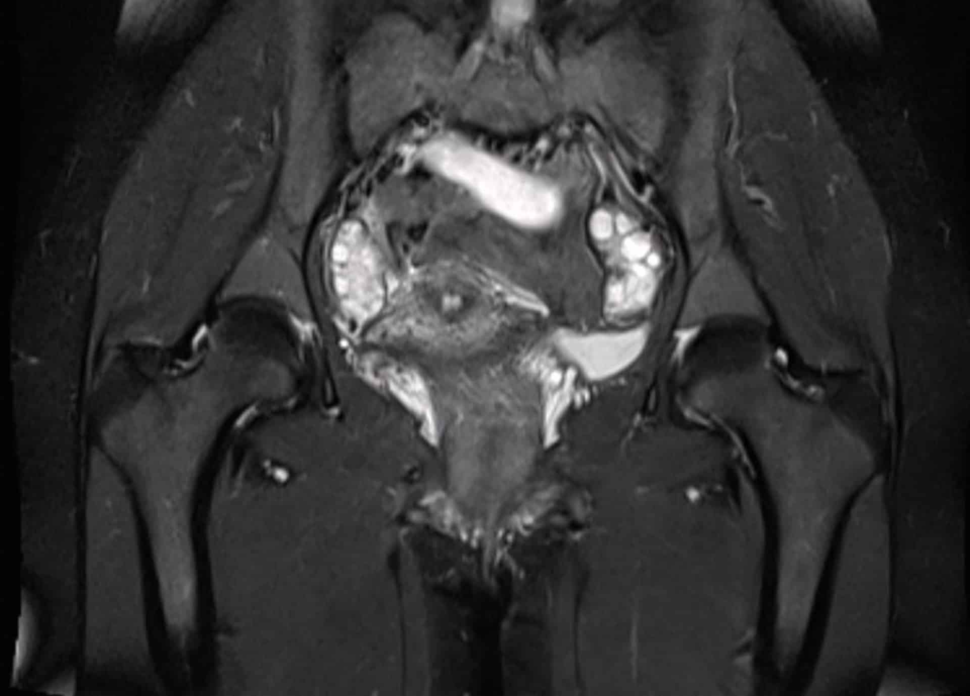 IRM pelvienne | Centre de radiologie IRM et scanner | Imagerie médicale HPA | Antony