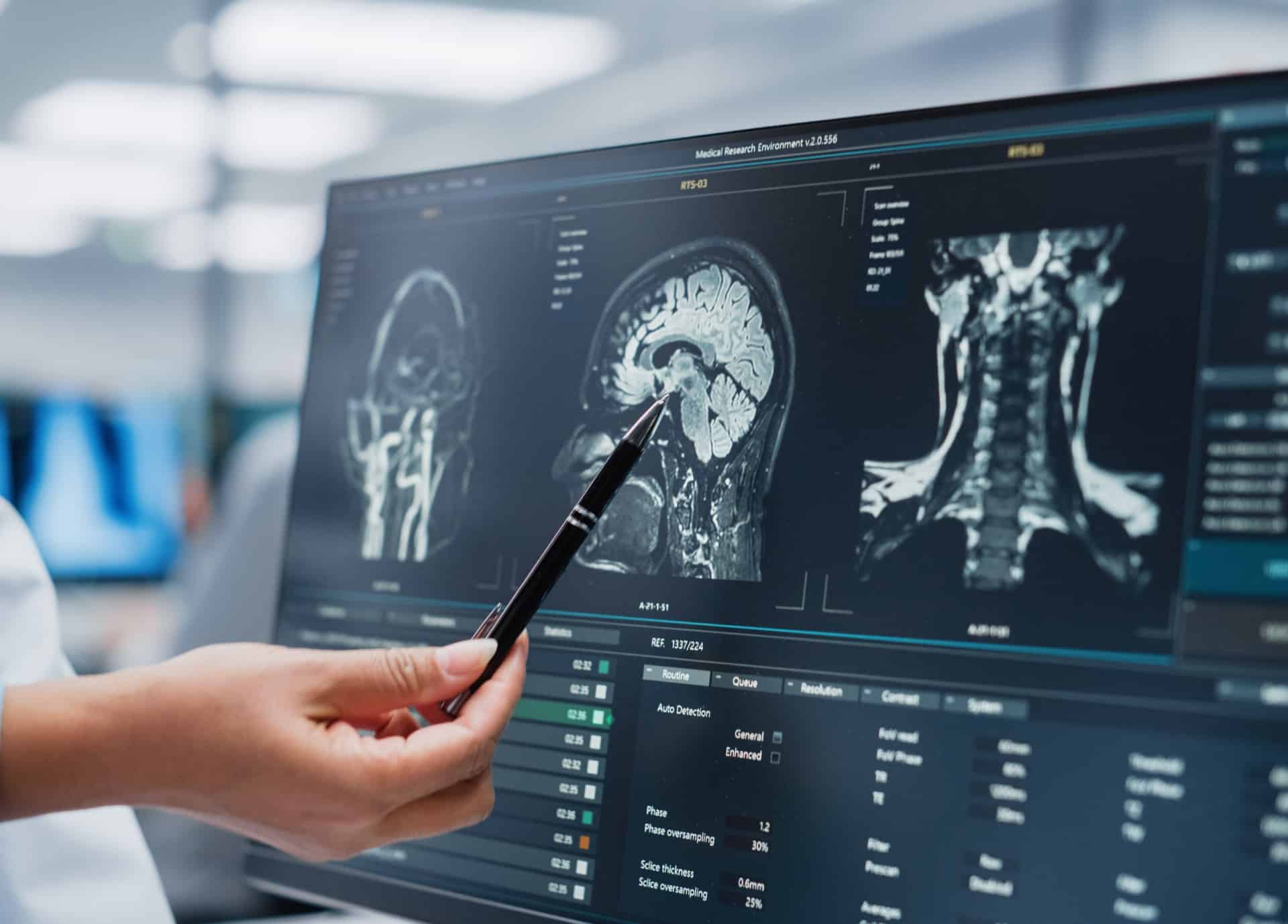 Neurologie - ORL | Centre de radiologie IRM et scanner | Imagerie médicale HPA | Antony