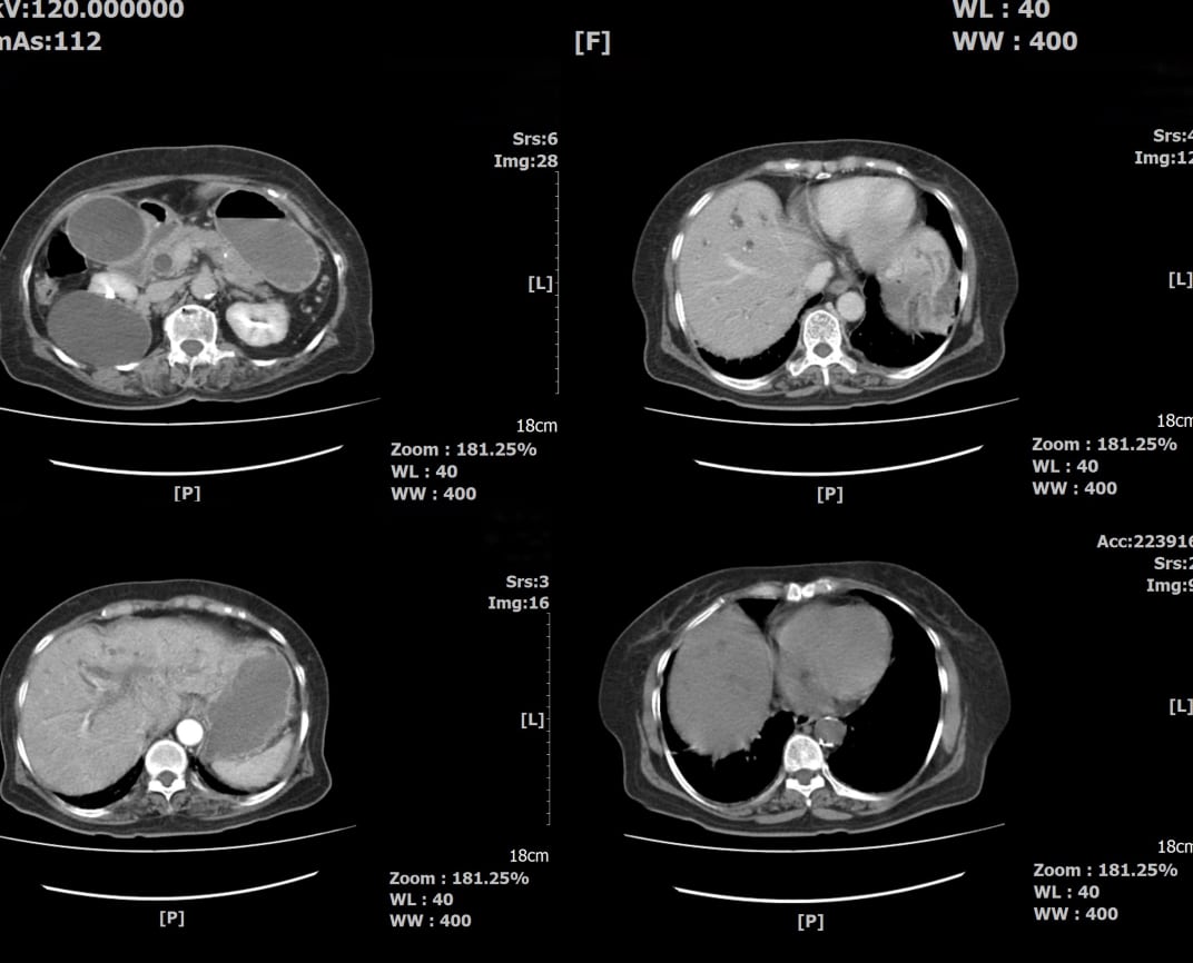 RADIOLOGIE, CT SCANNER ET IRM à vendre à Centre d'Affaires Médical