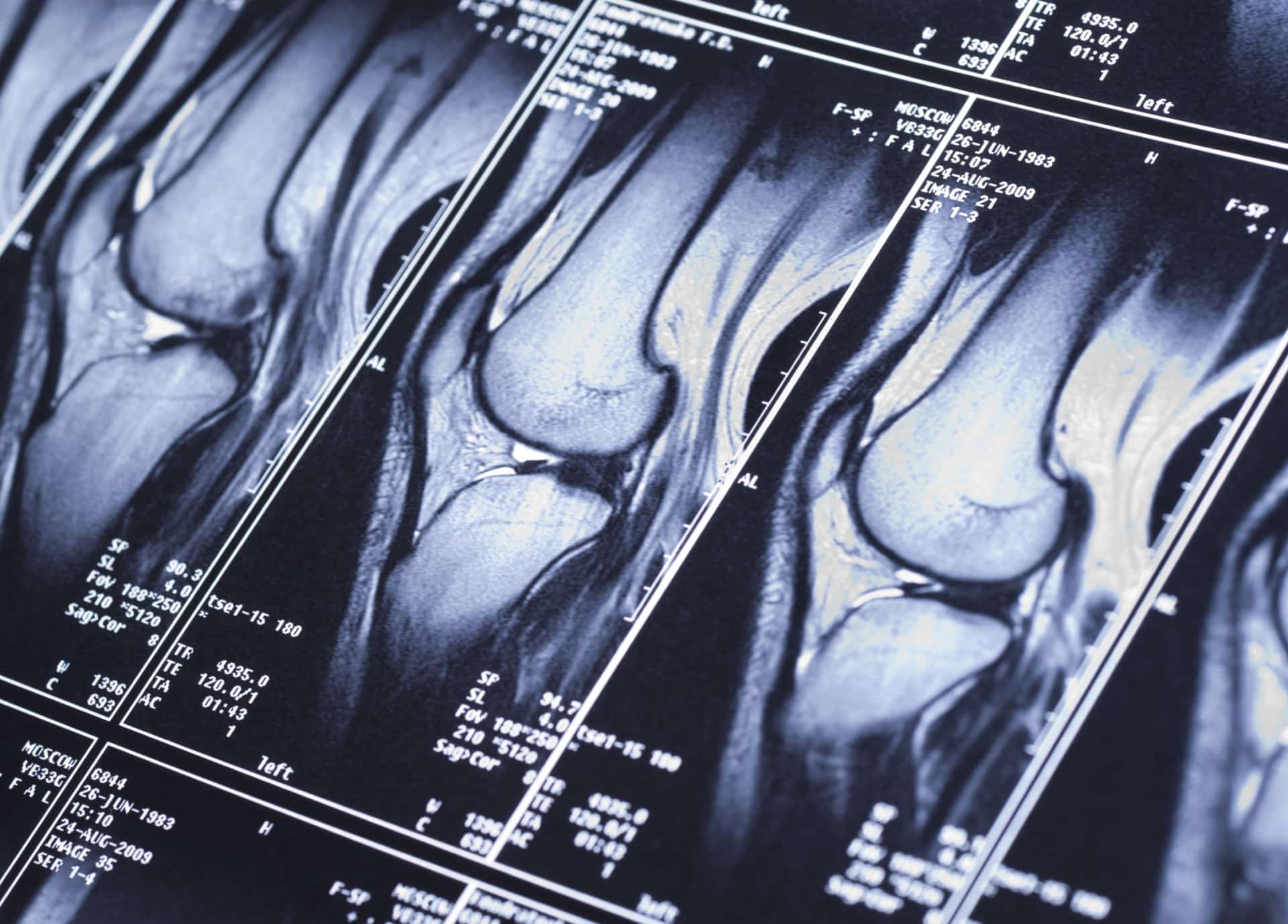 Ostéo-articulaire | Centre de radiologie IRM et scanner | Imagerie médicale HPA | Antony