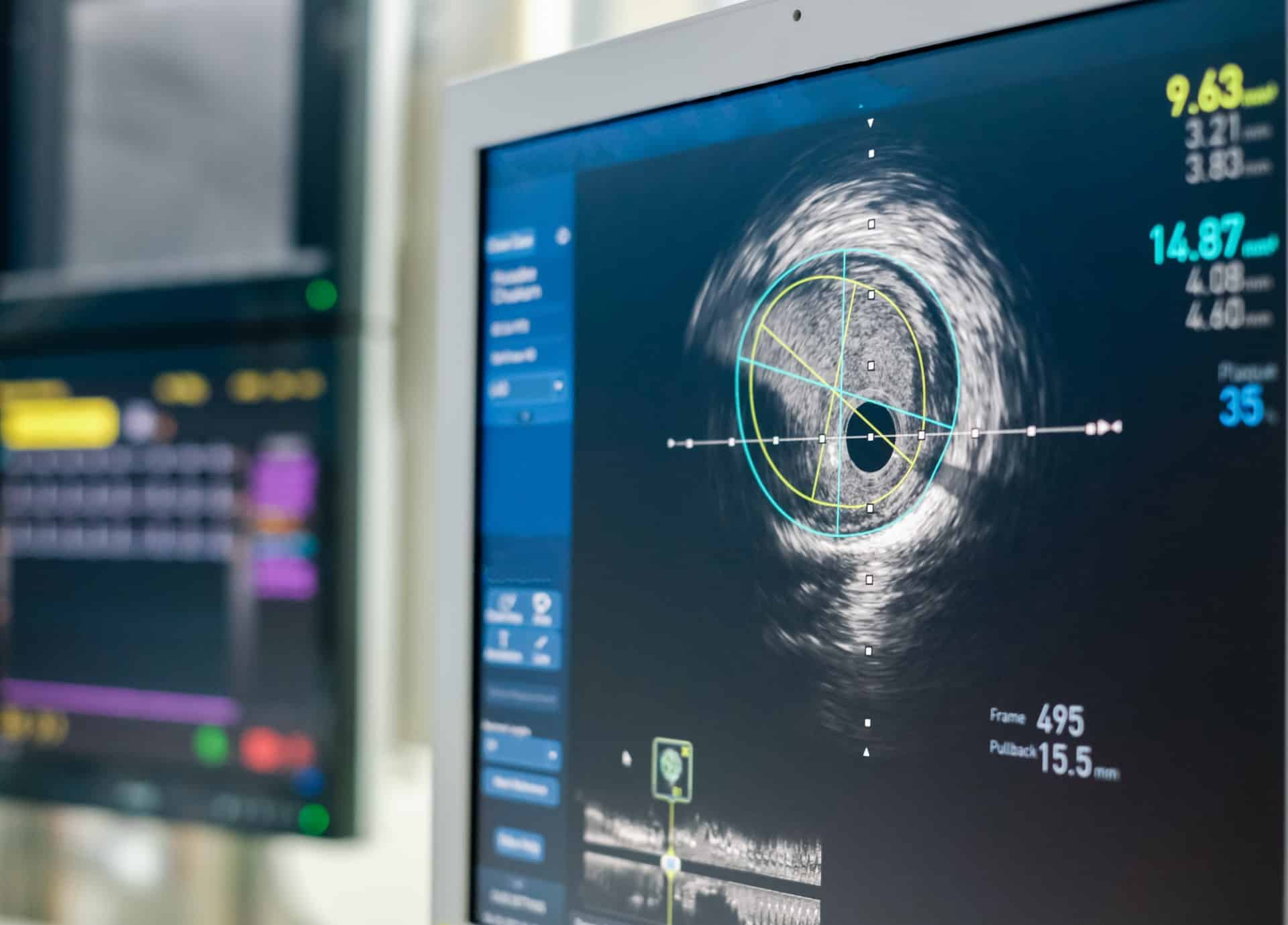 Pose de PICC Line - PAC | Centre de radiologie IRM et scanner | Imagerie médicale HPA | Antony