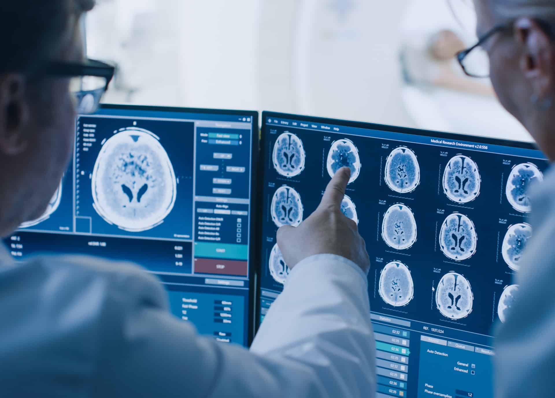 Scanner cérébral | Centre de radiologie IRM et scanner | Imagerie médicale HPA | Antony