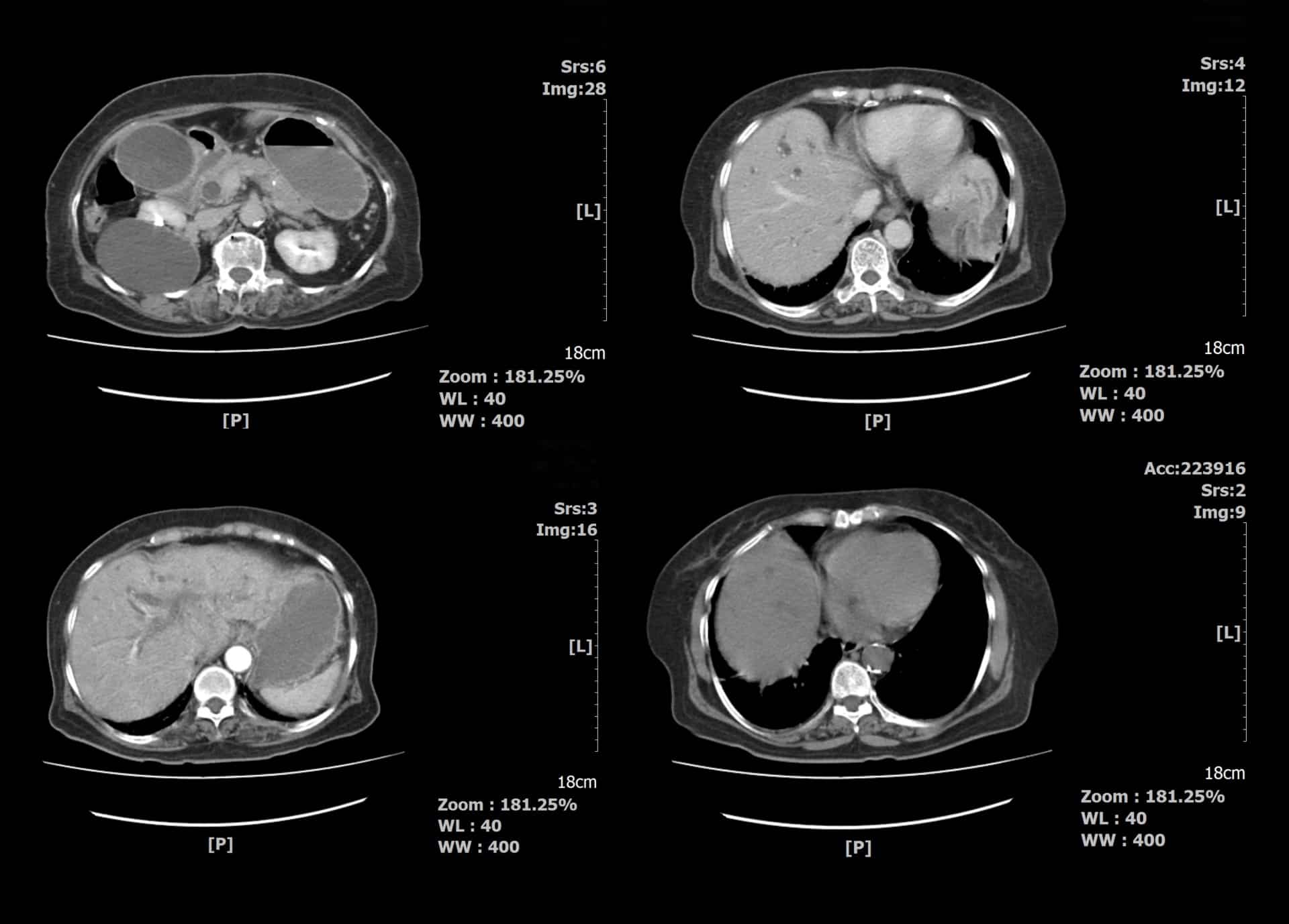 Imagerie du système digestif | Centre de radiologie | Olympe ...