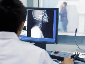 radiographie des cervicales