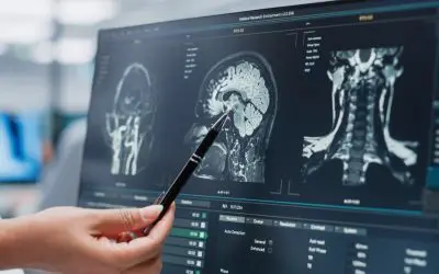 Neuroradiologie et imagerie ORL