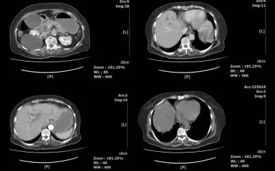 Imagerie de l’abdomen à Olympe Imagerie