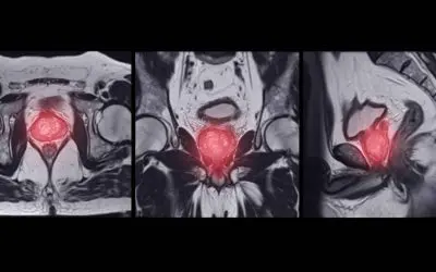 Imagerie urologique à Olympe Imagerie