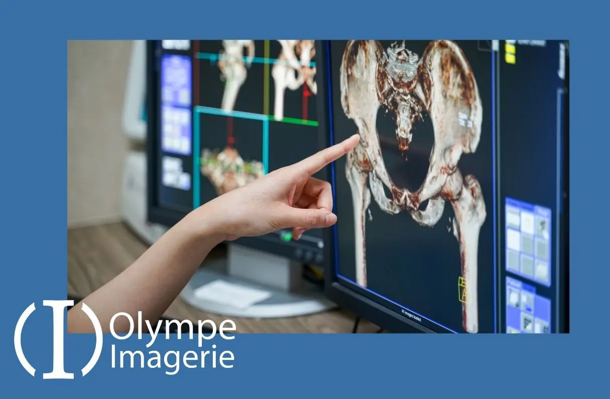 Tele-expertise Vignette Blog OI La Télé-expertise à Olympe Imagerie