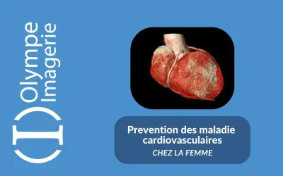 Maladies Cardiovasculaires : dépistage précoce et innovation avec le coroscanner