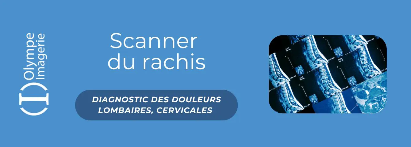 TDM rachis Blog SEO OI Scanner du rachis à Olympe Imagerie