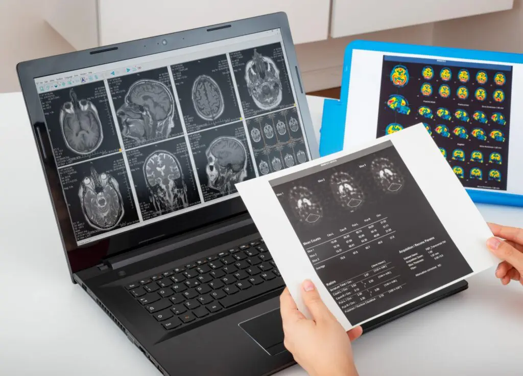 Nos examens | Centre de radiologie IRM et scanner | Imagerie médicale HPA | Antony