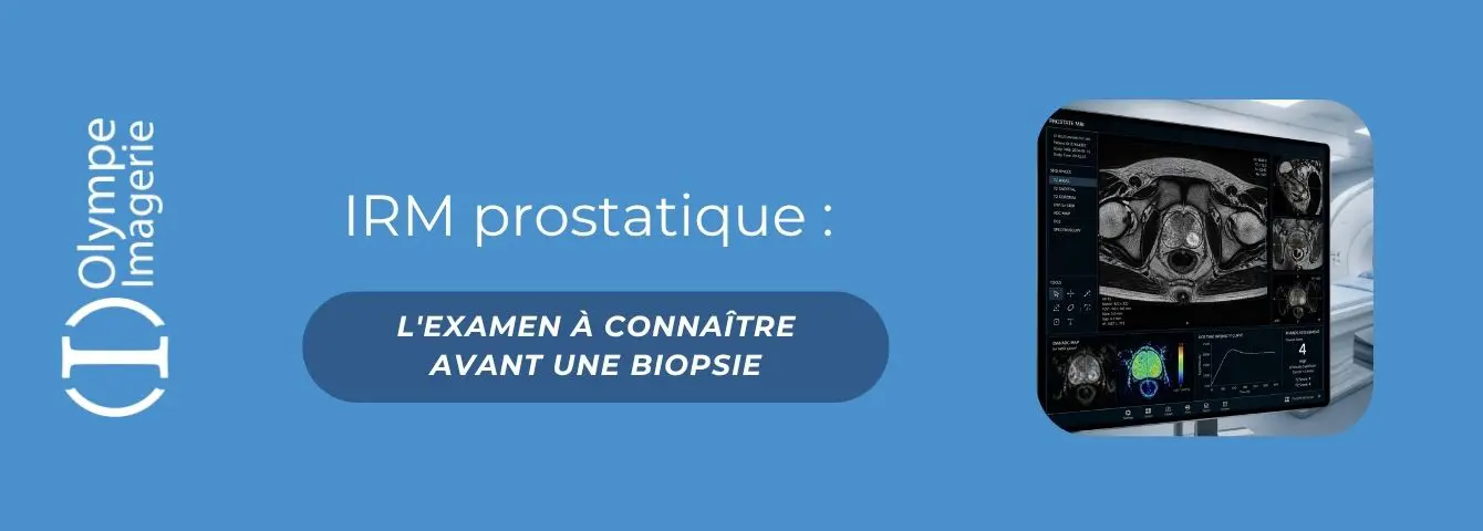 IRM PROSTATE