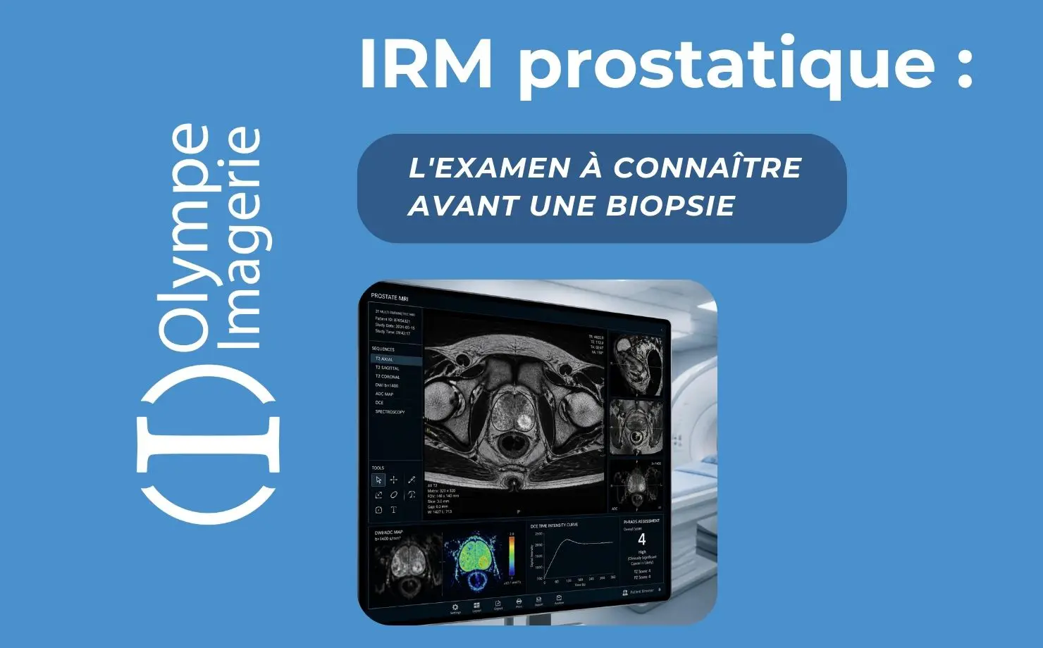 IRM PROSTATE