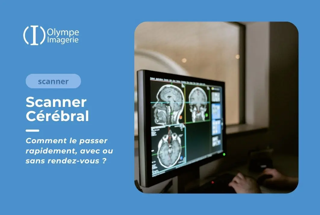 Scanner cérébral Olympe Imagerie