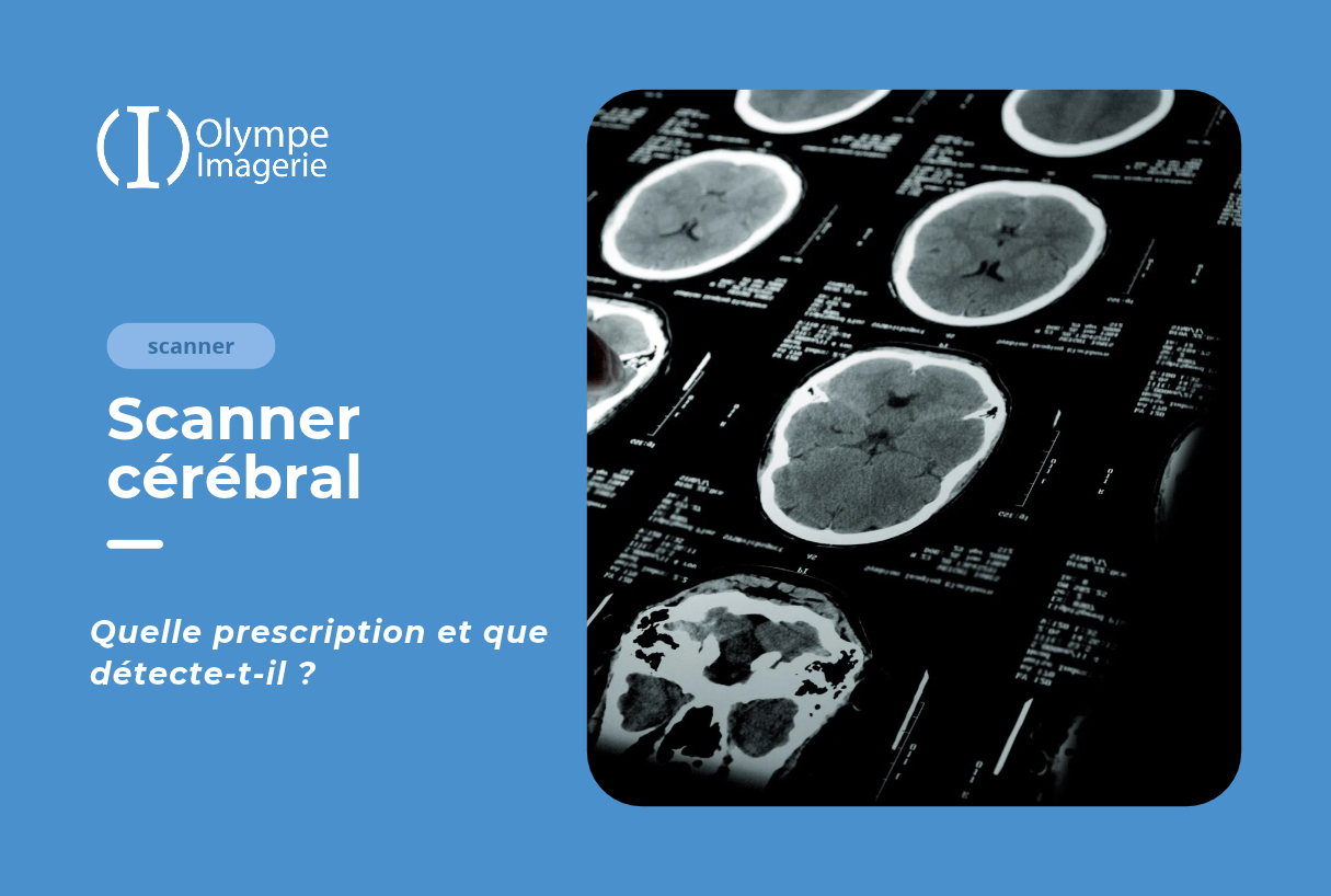 Scanner cérebral